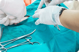 emesztoszervi mutetek